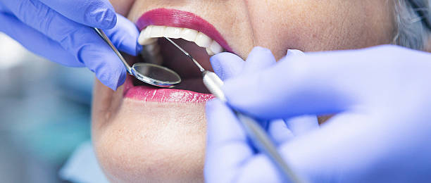 Best Emergency Tooth Extraction in Wellman, IA